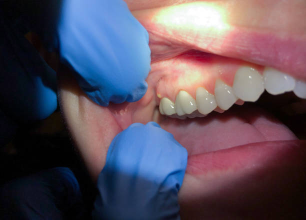 Best Knocked-Out Tooth Emergency  in Houston, PA